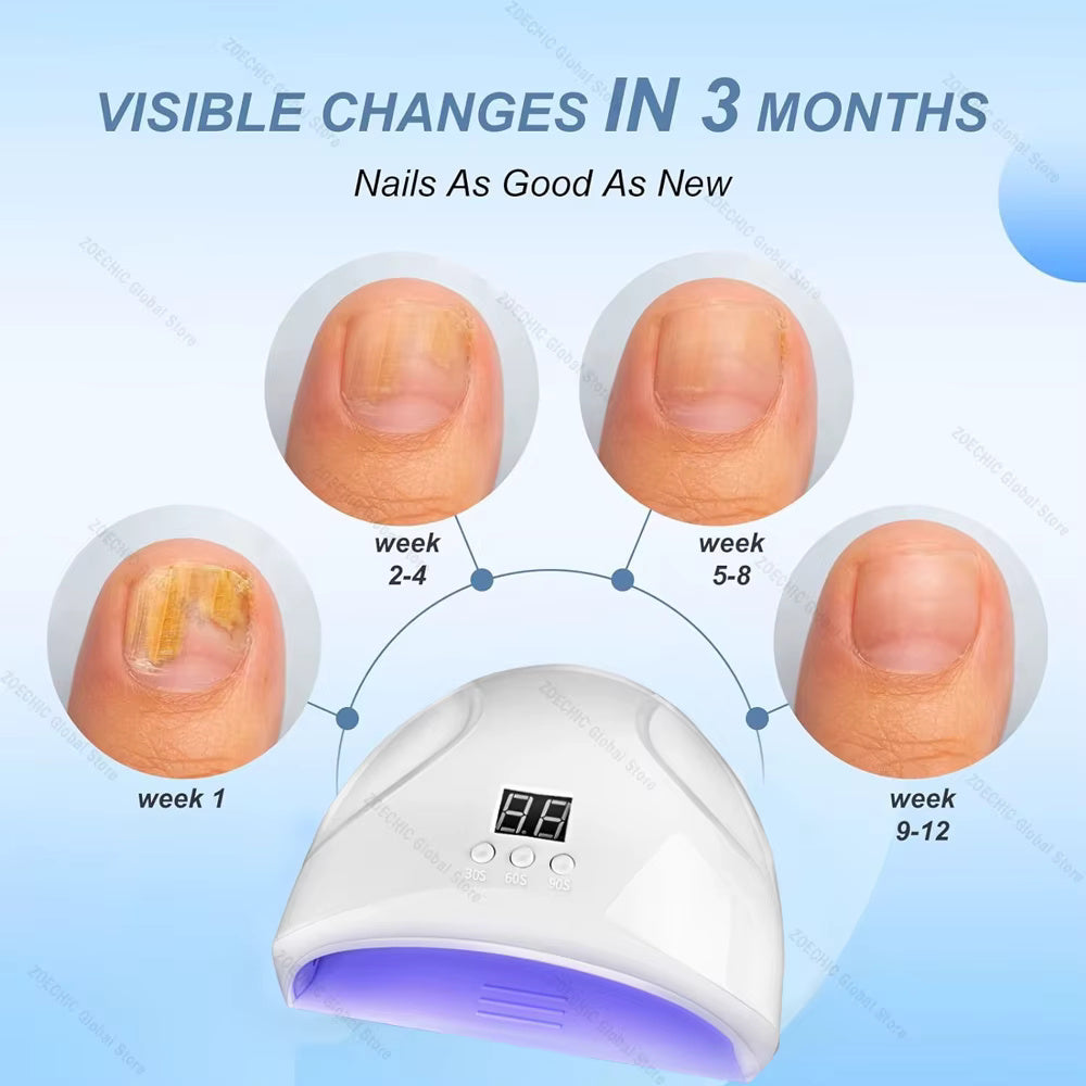 Borelis Fongile Réparateur d'ongles