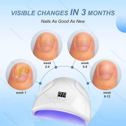 Borelis Fongile Nail Repairer